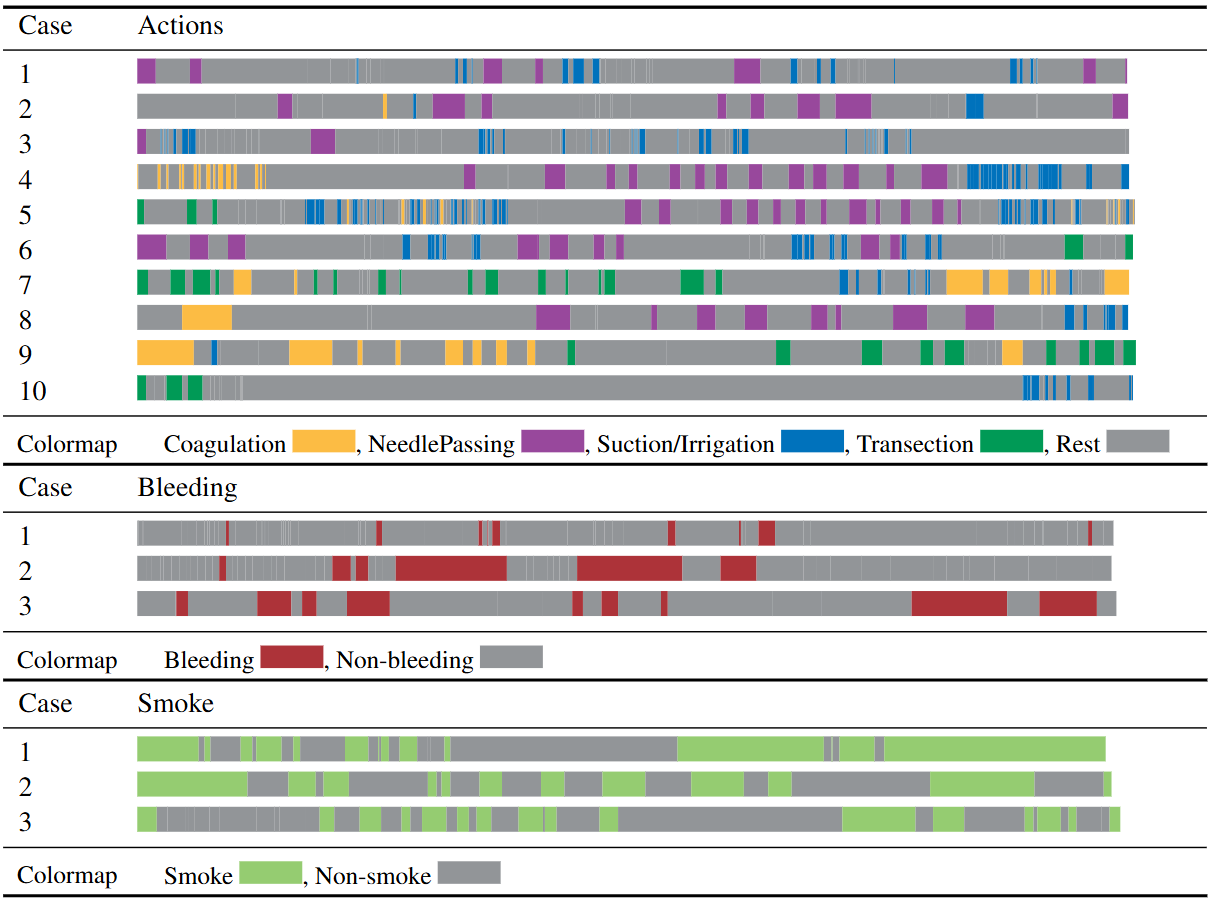 Timeline visualization actions