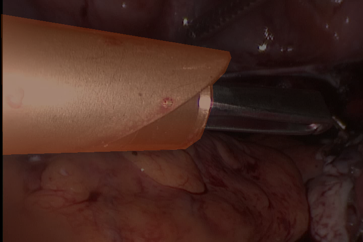 morcellator